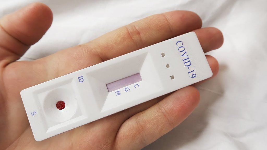 система теста на ковид